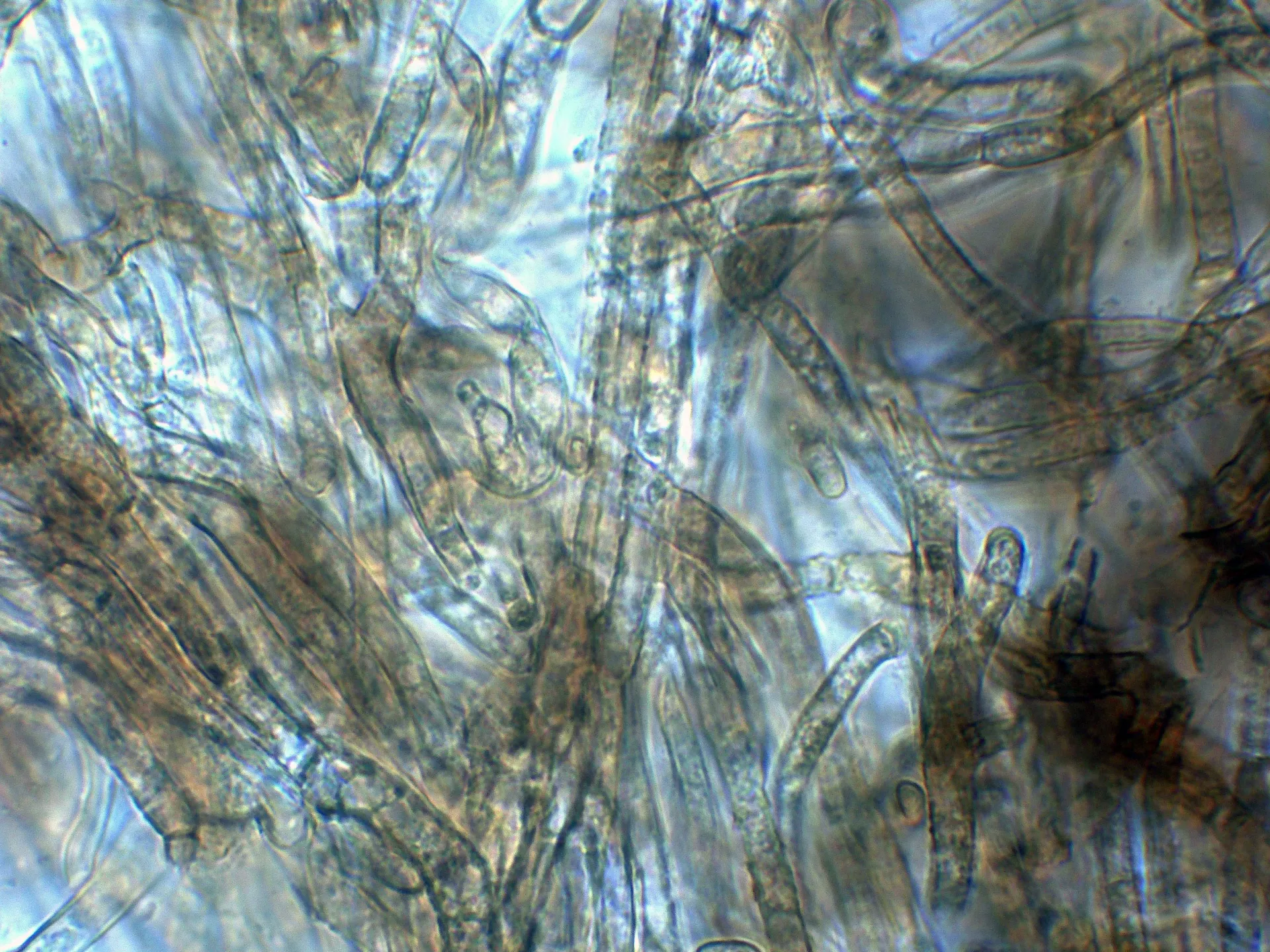 Microscopía de Tricholoma pseudonictitans - 10 - Subpellis agua-002